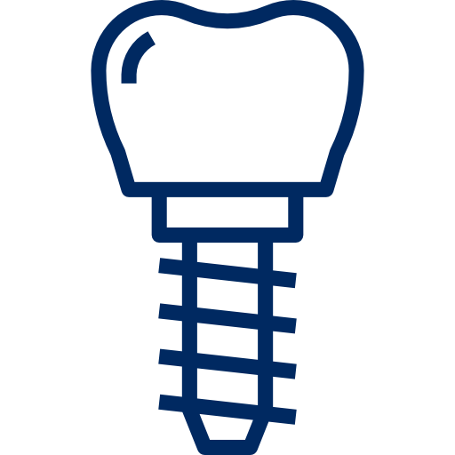 Implantes Dentários